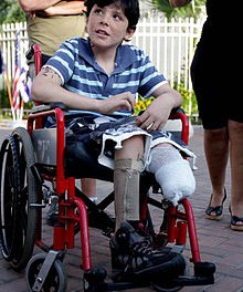 InjuredBoy
